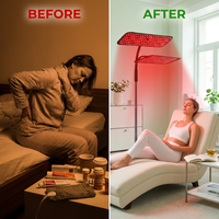 660Nm 850Nm LED Red Light Therapy Panel with Stand near Infrared Therapy Lamp Devices for Body Muscle Relax and Skin Care — Before & After