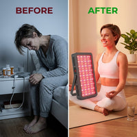 Red Light Therapy, Red near Infrared LED Panel, 72 Quad Chip Flicker Free Leds, Ultra Series, Clinical Grade Device - Popular — Before & After